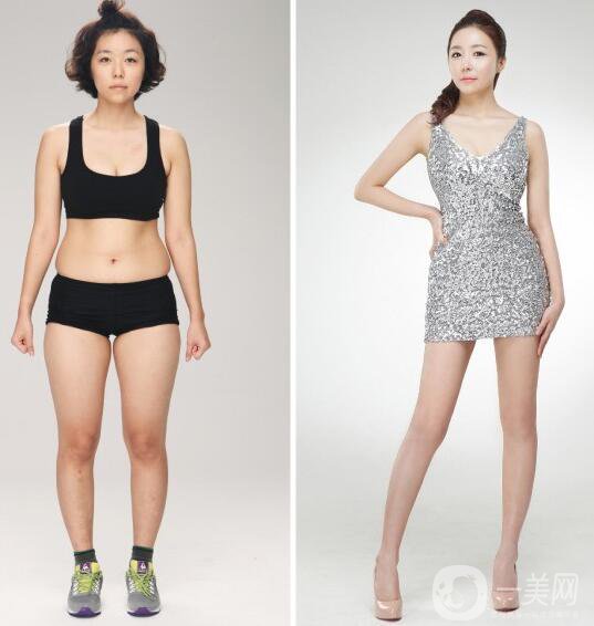 吸脂塑形前后圖