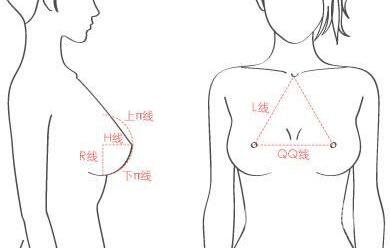 假體隆胸術(shù)有哪些特點？