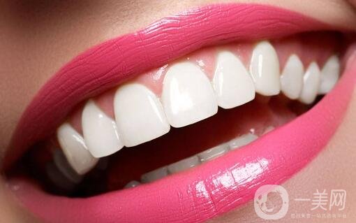 烤瓷牙的種類和優(yōu)缺點分別是什么呢？