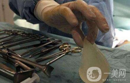 麥格假體隆胸多少錢?費(fèi)用貴嗎?