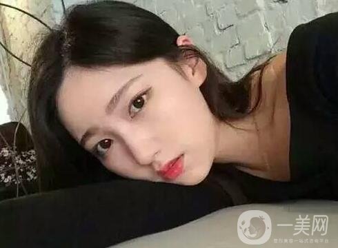 雙下巴吸脂后一個(gè)月還是有雙下巴，是失敗了嗎?