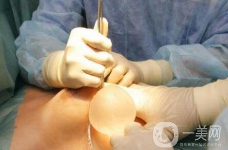 隆胸假體取出有沒有后遺癥？要怎么護(hù)理？