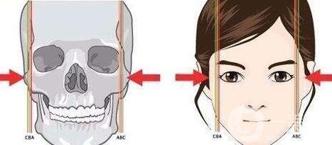哪家醫(yī)院做削骨手術(shù)比較*？正規(guī)醫(yī)院怎么選？