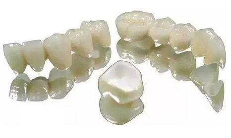 二氧化鋯全瓷牙修復(fù)*果怎么樣？