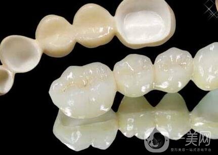 二氧化鋯全瓷牙修復(fù)*果怎么樣？