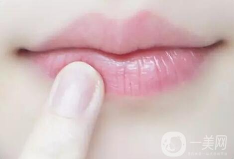 嘴角上揚(yáng)整形