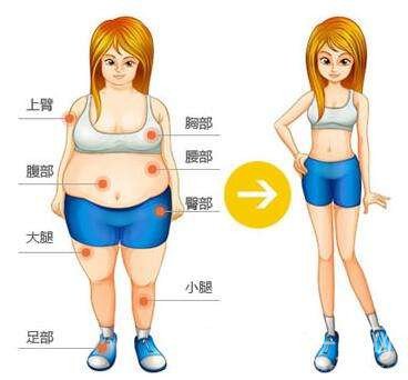 全身吸脂減肥好多錢？手術(shù)價格多少？