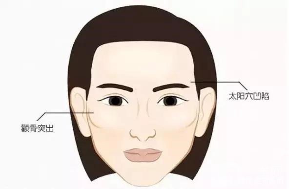 顴骨內(nèi)推和磨骨之間的區(qū)別是什么？哪個(gè)*果好些？