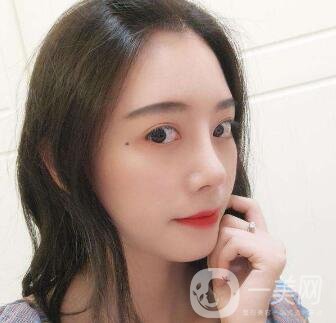 肋軟骨隆鼻為什么老受推薦？到底好在哪里？