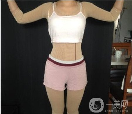 局部吸脂痛苦嗎?多久可以恢復呢?