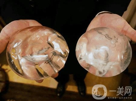 曼托假體和麥格假體哪種手感更好？教你怎么選擇？