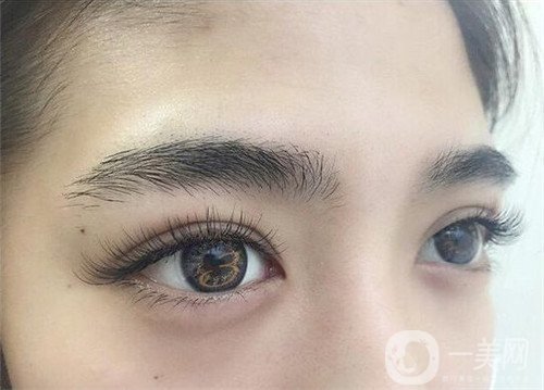 眼部衰老怎么辦？做手術(shù)是*好的解決辦法！