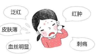 去紅血絲的*方法有哪些?