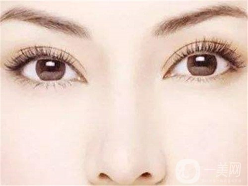 假體隆鼻多久完全消腫？怎么加速消腫呢？