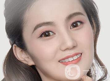 歪鼻矯正注意事項(xiàng)