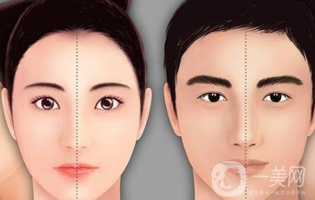 歪鼻矯正注意事項(xiàng)