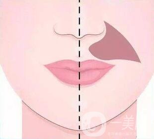 怎樣去鼻唇溝法令紋?小炒招~