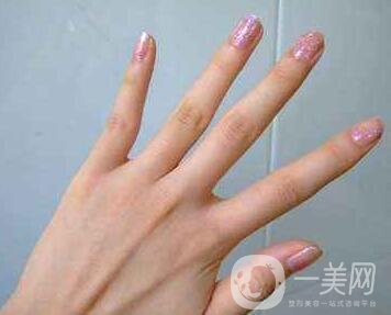 怎樣去掉手上的老年斑？還會再生嗎？