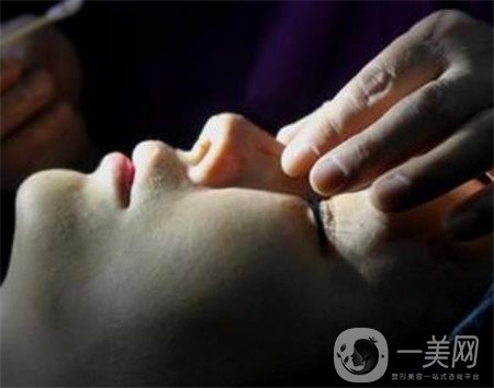 硅膠隆鼻能保持多久？可以終身保持嗎？