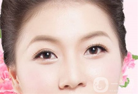 韓式開(kāi)眼角多少錢(qián)？普遍價(jià)位是多少？