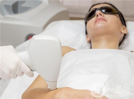 激光脫毛好嗎？有副作用嗎？