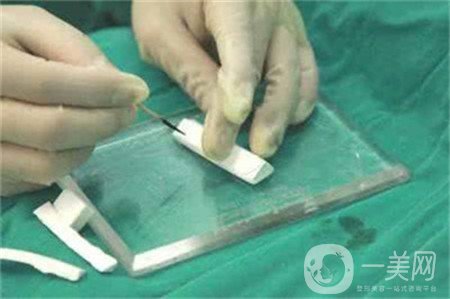 膨體隆鼻缺點(diǎn)是什么？?jī)?yōu)點(diǎn)有哪些？