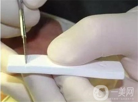 膨體隆鼻術(shù)后注意事項(xiàng)有哪些？需要忌口嗎？