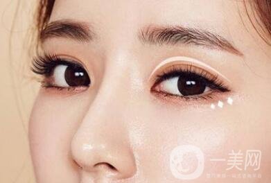 韓式微創(chuàng)雙眼皮手術(shù)