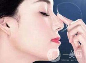 鼻子整形價格多少錢？影響價格因素有哪些？