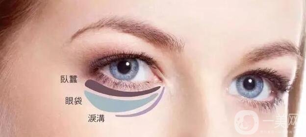 簡單去眼袋的方法大全如下