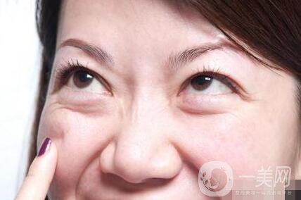 簡單去眼袋的方法大全如下
