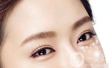 簡單去眼袋的方法大全如下