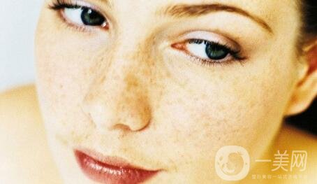 怎樣才能去黃褐斑?有哪些*的方法?