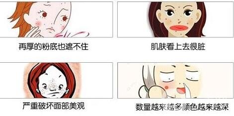 怎樣才能去黃褐斑?有哪些*的方法?