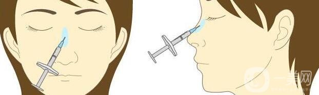 注射膠原蛋白隆鼻好嗎?