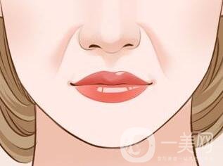 自體脂肪填充法令紋*果怎么樣?要多久才會(huì)消腫?