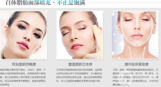 自體脂肪填充臉會僵嗎?術(shù)后感覺是怎樣的?