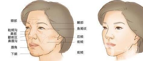 體脂肪填充存活