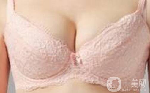 自體脂肪填充胸部