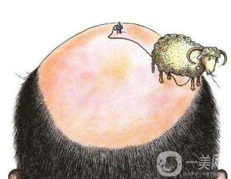 廣州種植頭發(fā)要多少錢?影響因素說(shuō)明