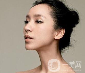 請問假體隆鼻手術(shù)需要多少錢呢？