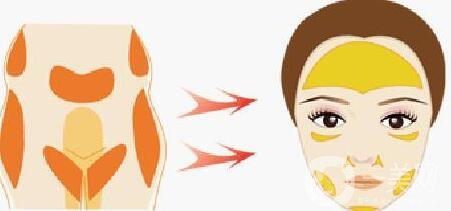 自體脂肪填充術(shù)前檢查及術(shù)后護(hù)理事項(xiàng)