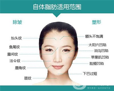 北京自體脂肪填充醫(yī)院有哪些？好的有哪些？