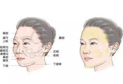 北京自體脂肪填充醫(yī)院有哪些？好的有哪些？