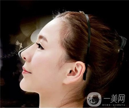 假體隆鼻術(shù)價(jià)格大概是多少？求告知