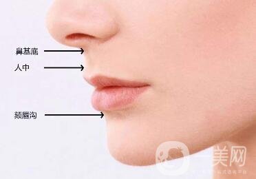 下巴突出怎么整？矯正手術原來是這么做的