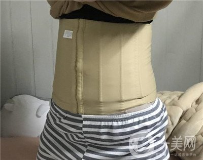 腰腹環(huán)吸后要腫多長時(shí)間呢？可以活動(dòng)嗎？
