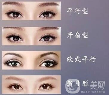 雙眼皮形狀