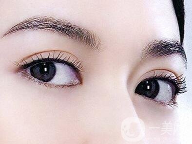 雙眼皮形狀