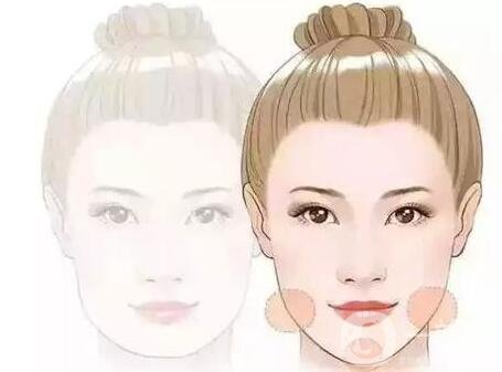 注射玻尿酸是整容嗎?能帶來哪些變化?